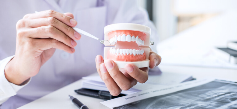 歯周病治療後のライフスタイル変化