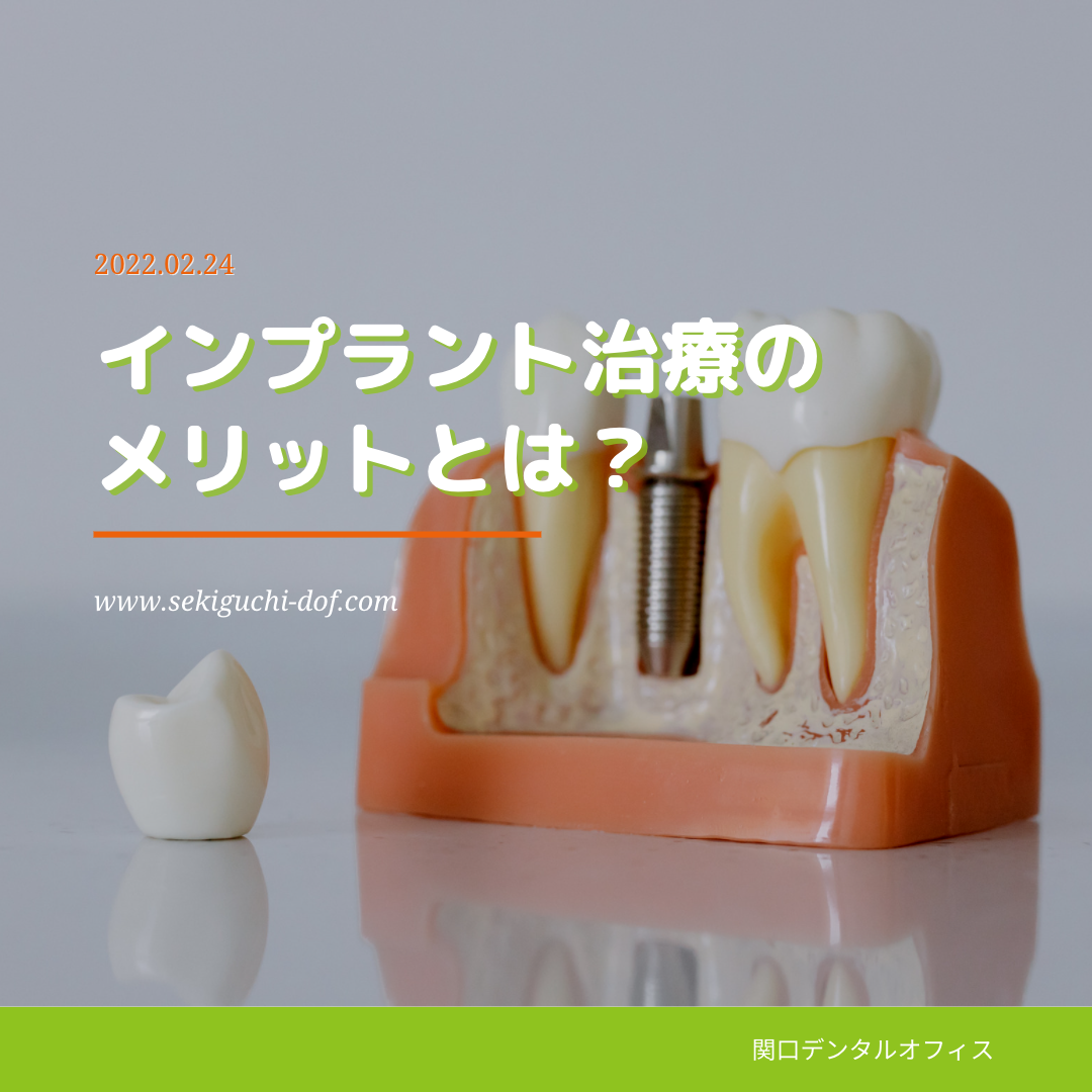 インプラント治療のメリットとは？ | 【公式】関口デンタルオフィス