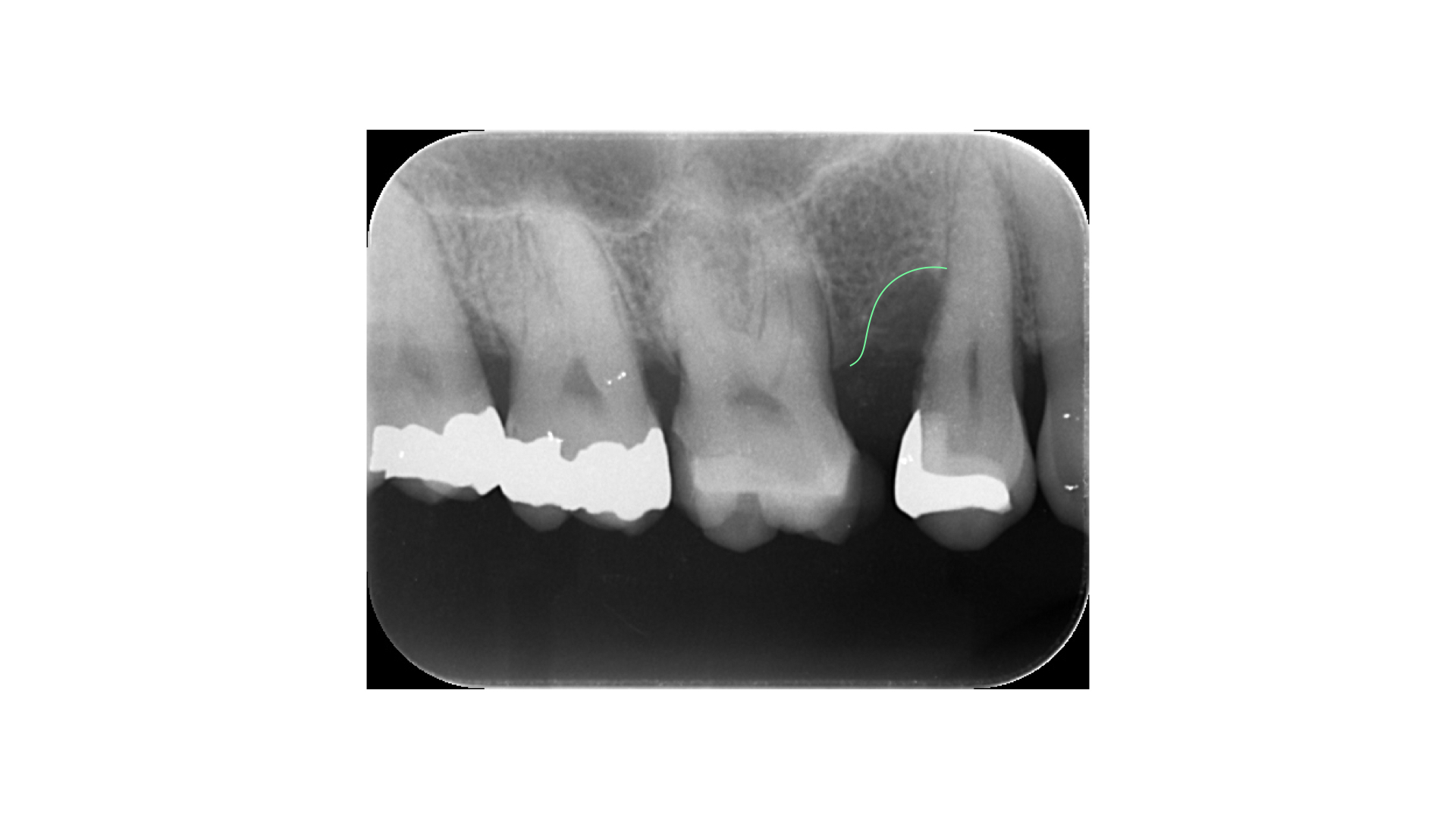 加湿器を使ってみる